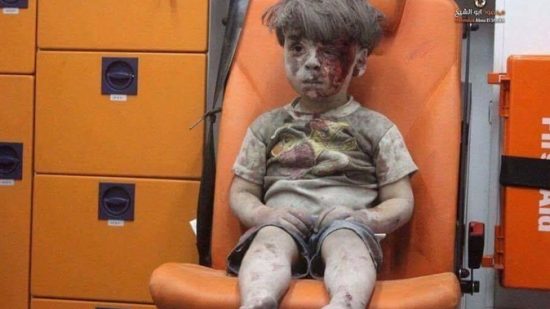 الجالية المصرية فى النمسا تتضامن مع الطفل عمران ضحية قصف حلب 