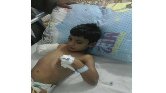 بالصور.. طبيب بمستشفى سمالوط المنيا يتسبب في بتر يد الطفل روماني