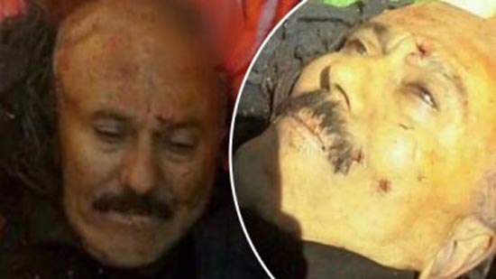 طبيب شرعى يمنى يكشف أسرار خطيرة حول جثة على عبدالله صالح