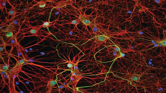 العلماء الروس وضعوا نموذجا اصطناعيا من خلية عصبية يحاكي عمل الدماغ