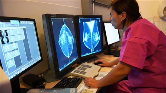 الذكاء الاصطناعي يتفوق على الأطباء في تشخيص سرطان الثدي
