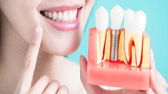 ابتعد عنها.. أعراض وعلامات تؤكد فشل زراعة الأسنان