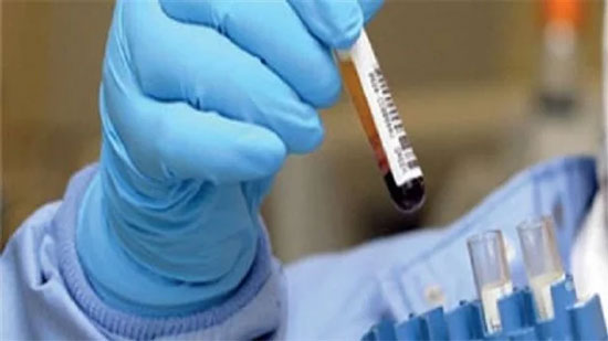 هولندا تسجل 80 وفاة جديدة بفيروس كورونا