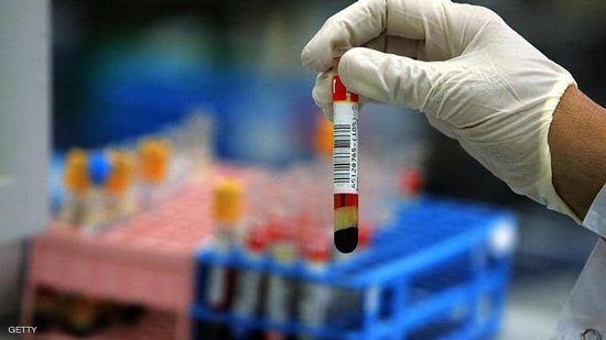  دايلي اكسبريس : شركة دواء سويسرية طورت اختبار الأجسام المضادة لفيروس كورونا بنجاح  100%
