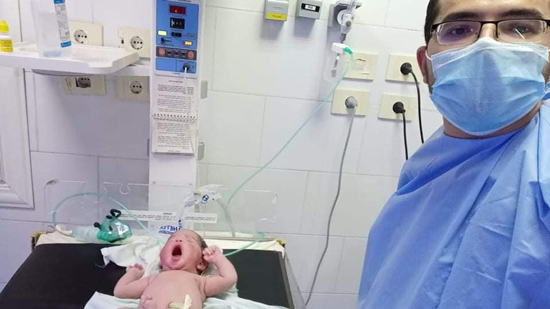  ولادة قيصرية لمريضة مصابة بكورونا بمستشفى بوش العام