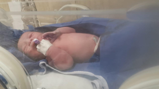  الصحة : نجاح عملية ولادة قيصرية لأم مصابة بـ كورونا