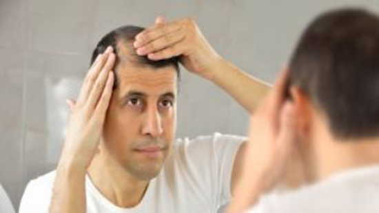 كورونا قد يسبب تساقط الشعر المرتبط بالقلق والإجهاد