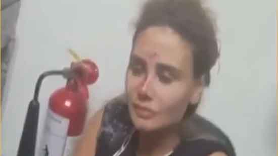 إصابة زوجة الفنان رامي عياش فى انفجار مرفأ بيروت