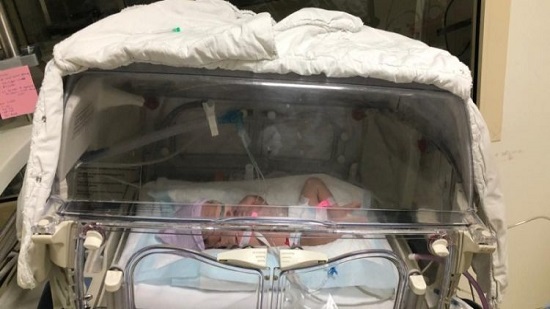 نجاح عملية ولادة لمريضة بـ«رئة اصطناعية» مصابة بـ«كورونا» في السعودية