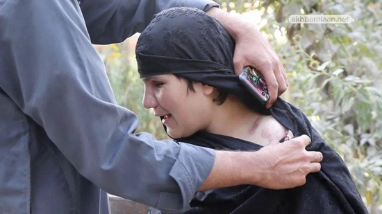 ضابطة شرطة في أفغانستان تفقد بصرها بسبب عملها