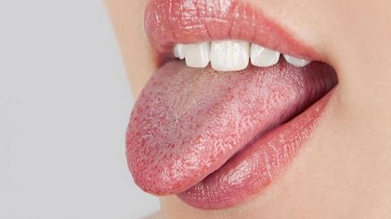 منها بكتيريا اللسان.. 5 أسباب لرائحة الفم الكريهة