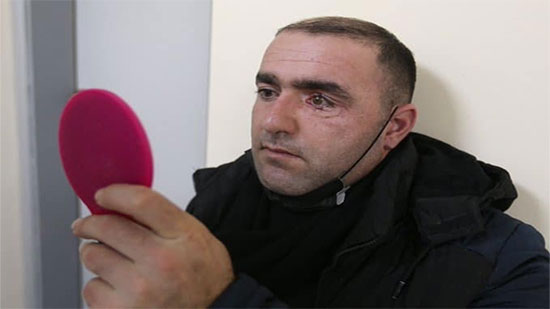 مواطن أذربيجاني يستعيد بصره بفضل طاقم طبي إسرائيلي