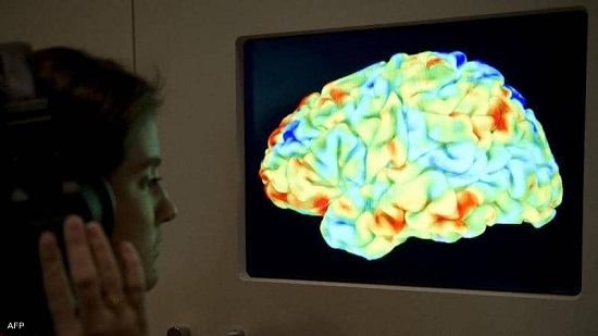 أرشيفية.. صورة دماغ بشري