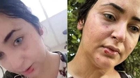  خالد منتصر: الاعتداء على طبيبة الزقازيق لعدم ارتداء الحجاب نتيجة الفاشية الدينية 