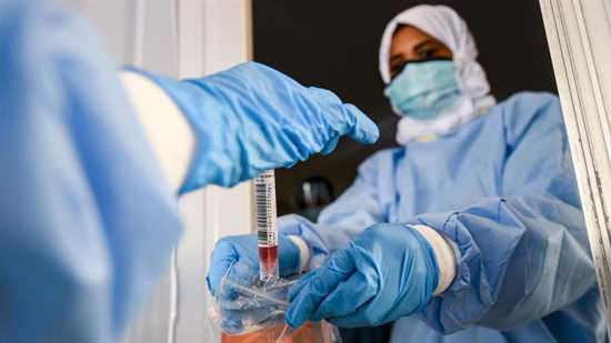 مصر تسجل 923 اصابة جديدة بفيروس كورونا و55 حالة وفاة