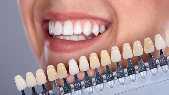 6 طرق للحصول على أسنان ناصعة مدى الحياة