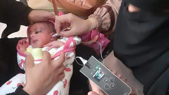 توقيع الكشف الطبي على 11 ألف طفلاً من حديثي الولادة بالمنيا