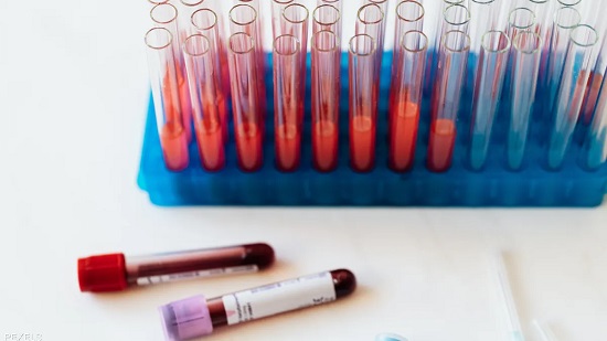 الفحص الجديد يسير بالطريقة التقليدية عبر البحث في الدم.