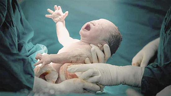  «الصحة»: خفض معدلات الولادات القيصرية إلى 61% خلال شهري يناير وفبراير 2023