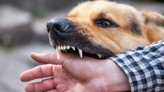 22 مصابا في حادث عقر كلب في أوسيم.. والطب البيطري يطارد 57 كلبًا