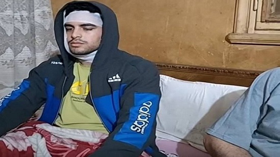  طالب يشوه وجه زميله ويصيبه بـ115 غرزة بسبب رفض طلب صداقته على فيسبوك